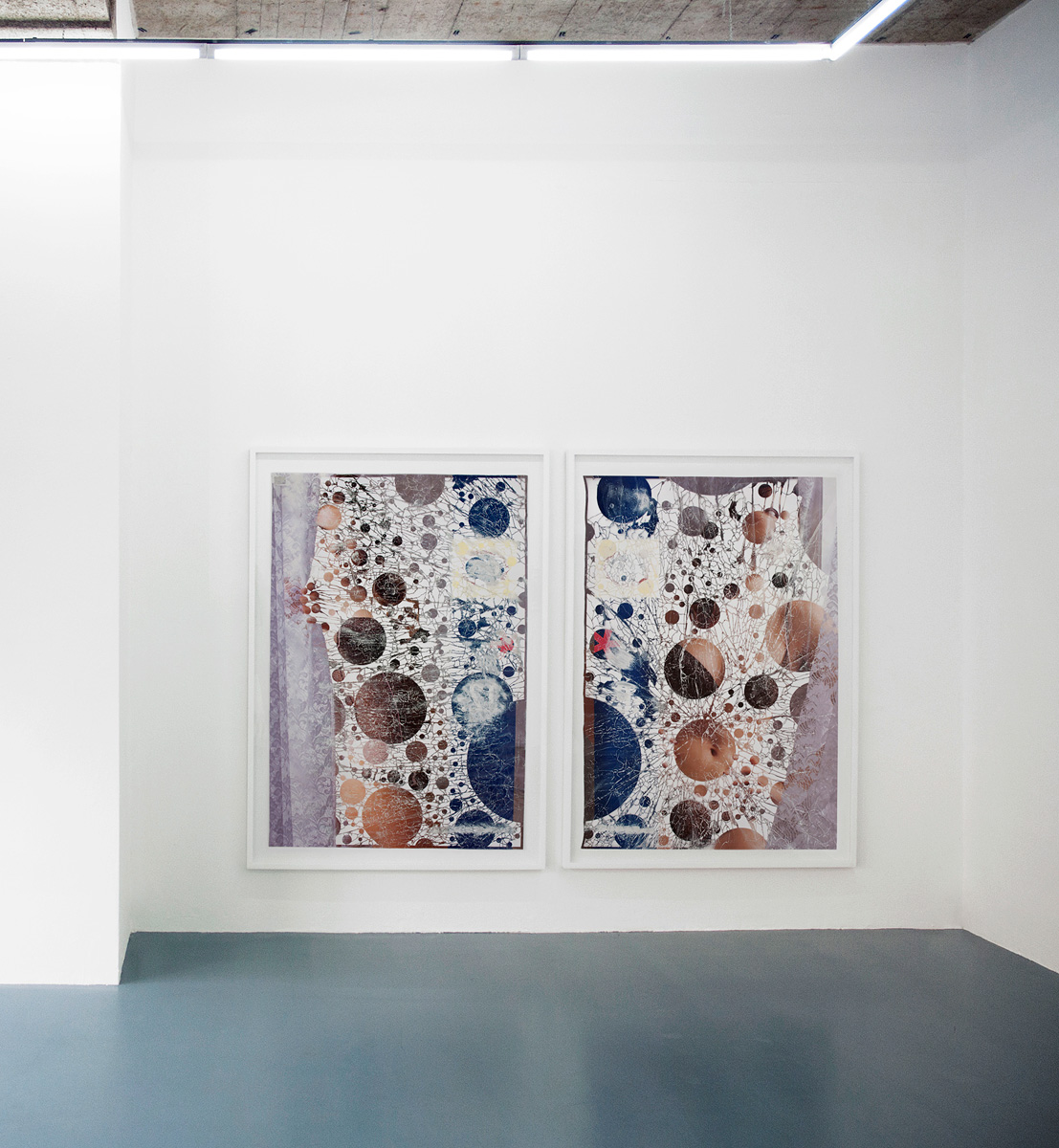 NabelDerWelt_installshot